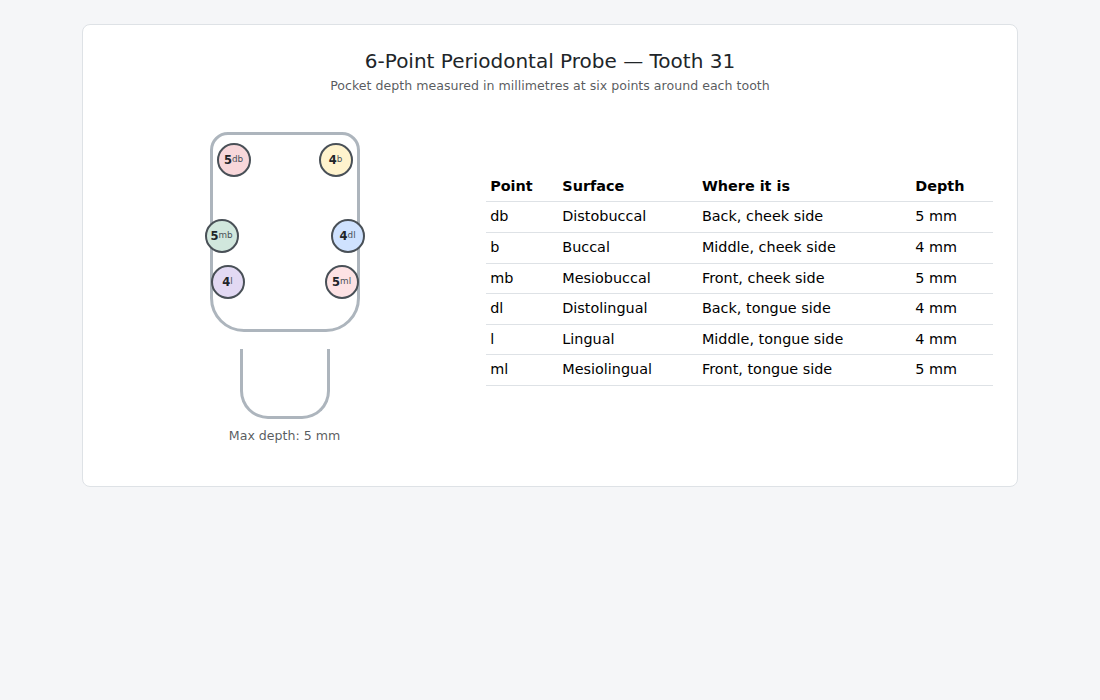 6-point periodontal probe on tooth 31 in VeriPath Dental