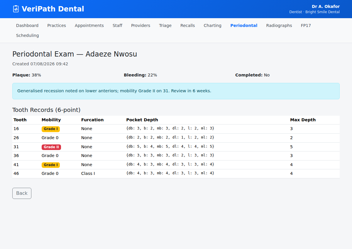 Periodontal exam detail with 6-point tooth records in VeriPath Dental