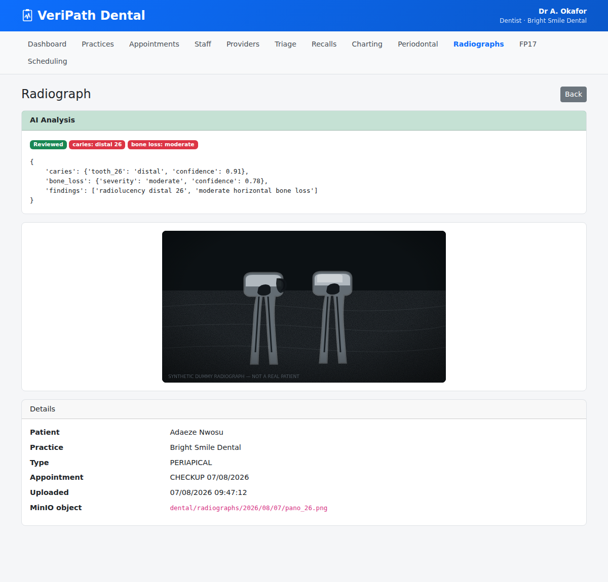 Radiograph detail with AI analysis in VeriPath Dental